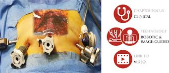 Use the menu below to choose the introduction section to get started. Robotic Radical Prostatectomy For Prostate Cancer Natural Evolution Of Surgery For Prostate Cancer Sciencedirect