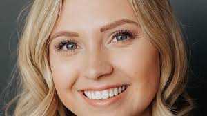 Opinion: U.S. Supreme Court upholds constitutional safeguards against undue  building fees