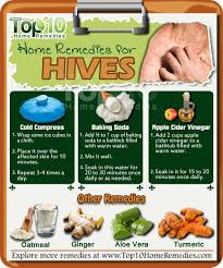 Home Remedies For Hives Top 10 Home Remedies Home Remedies For Hives Hives Remedies Natural Healing Remedies