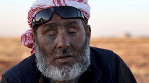 Cluster munition deaths in Ukraine pass Syria, fueling rise in a weapon the  world has tried to ban