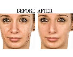 Healing Brush Photoshop Editing Projects :: Photos, videos, logos,  illustrations and branding :: Behance