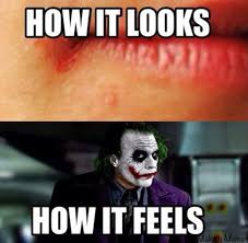 Funny Chapped Lips Dump A Day Funny Pictures Funny Shirt Sayings Funny Husky Meme