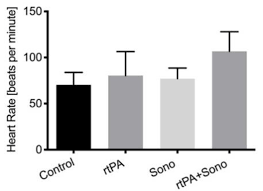 List of 18 rtpa definitions. Jcm Free Full Text Intrahematomal Ultrasound Enhances Rtpa Fibrinolysis In A Porcine Model Of Intracerebral Hemorrhage