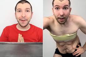 Nikocado Avocado Has Surgery to Remove 10 Lbs. of Loose Skin: I Had to  Keep Pushing My Stomach into My Pants