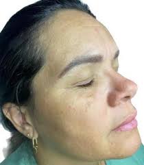 CENTRO UNIVERSITÁRIO DO VALE DO ARAGUAIA