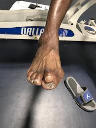Lebron Feet Big Sale Off 71