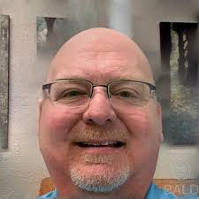 What do you think of my new bald look?