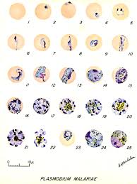 Ovale generally cause less serious illness, but the parasites can remain dormant in the liver for. Plasmodium Malariae Parasite And Disease Clinical Microbiology Reviews