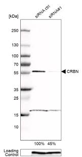 The brainspan project is a detailed atlas of gene expression across human development. Anti Crbn Antibody Produced In Rabbit Prestige Antibodies Powered By Atlas Antibodies Affinity Isolated Antibody Buffered Aqueous Glycerol Solution