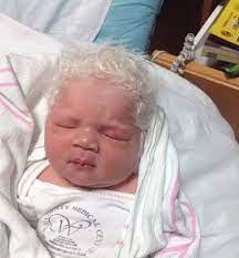Baby born with grey hair. Baby Born With Silver Hair And His Parents Are Baffled Blah News India Tv