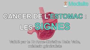 Quand consulter un médecin ? Cancer De L Estomac Les Signes Qui Doivent Inquieter Video Dailymotion