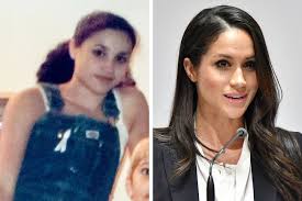 Meghan, duchess of sussex, урождённая рэ́йчел ме́ган маркл англ. Foto Megan Markl Do I Posle Plastiki