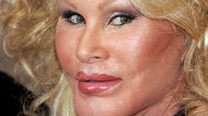 Jocelyn Wildenstein (84) genießt Date mit Verlobtem (57)