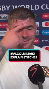 Malcolm Marx Injury Update: All Good after Stitches