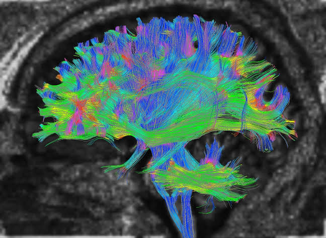 Blood Protein Linked to Lower Risk of Depression and PTSD After Traumatic Brain Injury