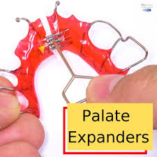 Maybe you would like to learn more about one of these? Palate Expanders The Most Important Orthodontic Appliance