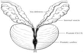 Prostate cancer is a common type of cancer in men, according to the mayo clinic. Https Cancerstaging Org Cse Physician Documents Ajcc Ppt 20 Prostate 20handout 20v2 Pdf