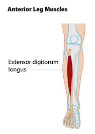 Injury Update Treating Extensor Tendonitis In 2020 Extensor Tendonitis Tendinitis Anterior Leg Muscles
