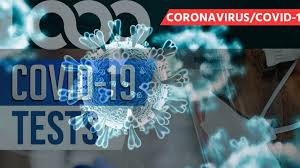 Since the beginning of this disease epidemic caused by the severe … Guadeloupe Records Over 300 New Covid 19 Cases Over Past Week Loop News