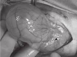 An Image At The Second Surgery The Distended Vagina Was Severely Download Scientific Diagram