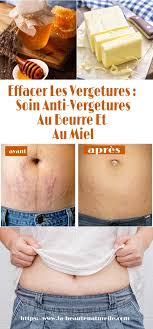 Pin On Sante
