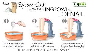 Home Remedies For Ingrown Toenails Top 10 Home Remedies Water Retention Remedies Water Retention Fluid Retention