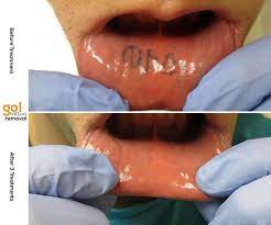 Inside Lip Tattoo Fade Time Tattoo Ideen