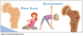 EFFETTI DELL'ESERCIZIO FISICO SULLE OSSA
