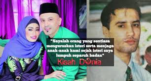 Buat pengetahuan korang, isteri edika mengalami lumpuh dari bahagian badan. 12 Tahun Edika Yusof Nazar Botak Kepala Kerana Isteri Lumpuh Kisah Dunia