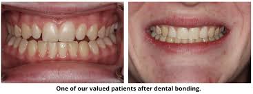 Truly a 5 star experience, every time i go there i feel as i'm going to the most prestigious dentist office in ny because that truly is what it is! Cosmetic Dentistry In South Weymouth Ma South Shore Dentistry