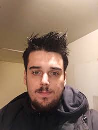 Man Receives Face Transplant After Suicide Attempt