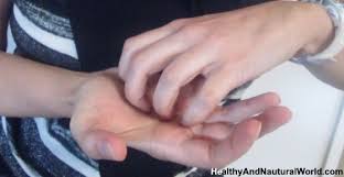 Here S Why You Should Never Ignore Itchy Palms Itchy Skin Remedy Itchy Feet Remedy Foot Remedies