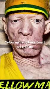El legado de Yellowman y Leroy Don Smart en Jamaica