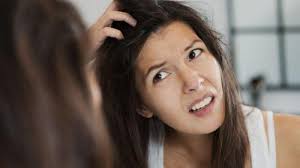 Penyebab masalah kulit kepala kering & cara mengatasinya. Dip6ulbcv6 Kdm