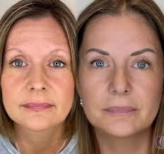 Enhanced Face Studio (@enhanced_face_studio) • Instagram photos and videos