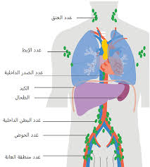الغدد اللمفاوية والسرطان عيادة د باسم مرقص