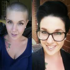 6months Of Hairgrowth Growing Out My Shaved Head Growingoutashavedhead Hair Styles Growing Out Shaved Head Stages Hair Inspiration