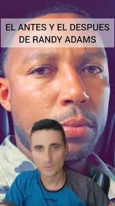 Perdió medio rostro. #supervivencia #emergencia #curiosidades