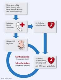 Herzdruckmassagen sind bei erster hilfe der wichtigste schritt. Wiederbelebung Bei Herz Kreislauf Stillstand