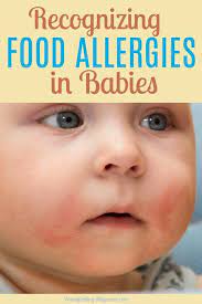 Food Allergies In Babies Who Breastfeed Common Signs And Solutions Baby Food Allergies Food Allergies Breastfeeding