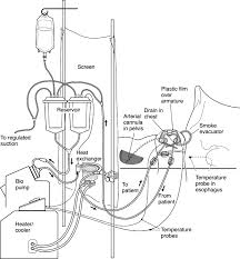 Treatment for malignant pleural mesothelioma. Hyperthermic Chemoperfusion For The Treatment Of Malignant Pleural Mesothelioma Seminars In Thoracic And Cardiovascular Surgery