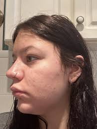 Reviews of Results Skin Care & Medi Spa LLC