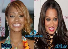Carmelo and la la anthony are the second most popular couple in the nba. Plasticsurgeryfac Hashtag On Twitter