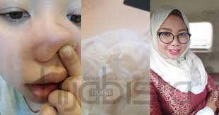 Berikut kami rangkum panduan cara memblokir iklan di hp samsung, xiaomi, asus, oppo dan advan yang tiba tiba muncul. Elak Habis Puluhan Ringgit Kongsi Petua Wanita Ini Hilangkan Whitehead Blackhead Modal Cuma 50 Sen Hijabista