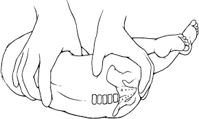 Preparation for surgery of the injured limb. Figure 1 Lateral Recumbent Position