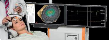 Nexstim develops and markets navigated the nbt system is based on nexstim's navigated transcranial magnetic stimulation, which allows for accurate, reproducible brain stimulation in therapy. Navigated Transcranial Magnetic Stimulation Ntms