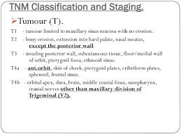 Or, cancer has spread to more than one. Maxillary Sinus Carcinoma