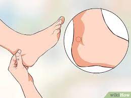 How To Use Acupressure To Induce Labour 11 Steps With Pictures