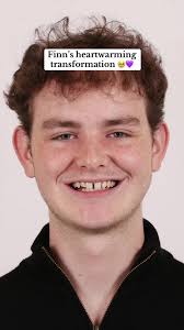 Finn New Teeth
