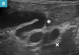 How much does an ultrasound machine cost? Neutrophilic Cholangitis In Cats Today S Veterinary Practice